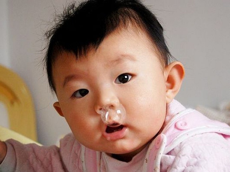Bé sổ mũi quanh năm: Nguyên nhân, có nguy hiểm không và cách xử lý hiệu quả
